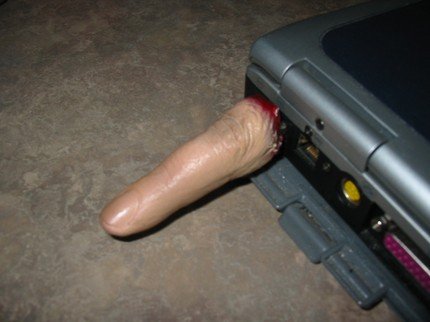 ��(g��)�Ԅ�(chu��ng)��Ѫ����ָU�P(p��n)